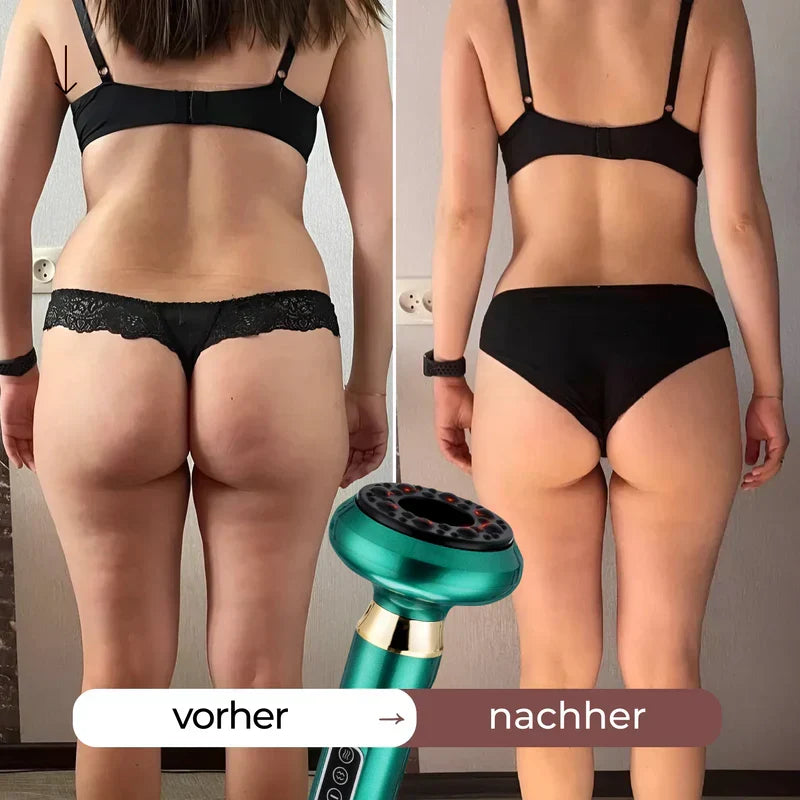 Anti-Cellulite Körperpflegegerät mit Wärmefunktion und Vibration für seidig weiche Haut.