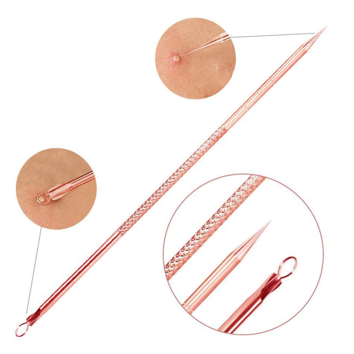 Komplettes Mitesser- & Pickelentferner-Kit. Beautytools für gründliche Gesichtsreinigung bei Damen & Herren.
