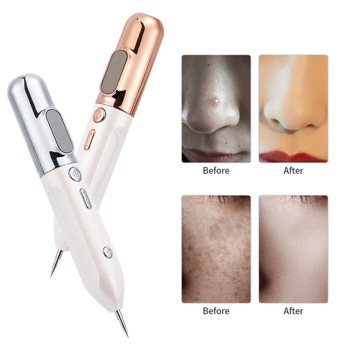 Detailansicht des Plasma Hautverjüngungsstifts GlowLift, ergonomisch für einfache Heimbehandlung.