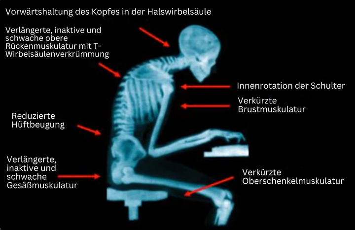 Ergonomische EMS Rückenstütze für eine aufrechte Haltung, ideal bei langer sitzender Tätigkeit.