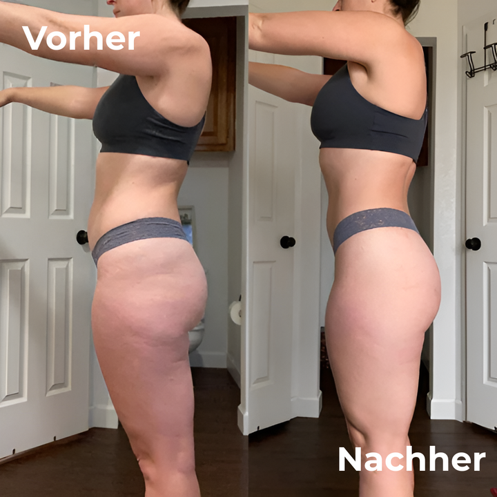 Anti-Cellulite-Massagegerät für Damen zur Reduzierung von Cellulite und Förderung der Durchblutung.